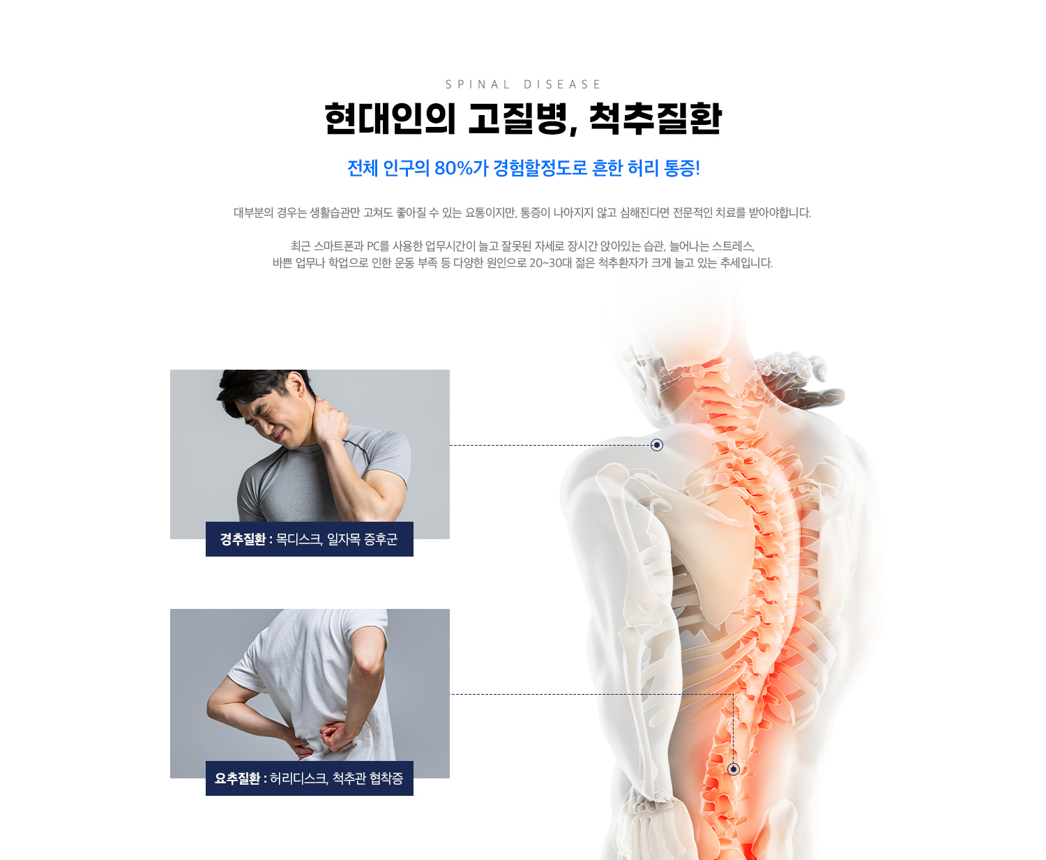 척추 질환
